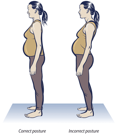 Posture Matters in Pregnancy