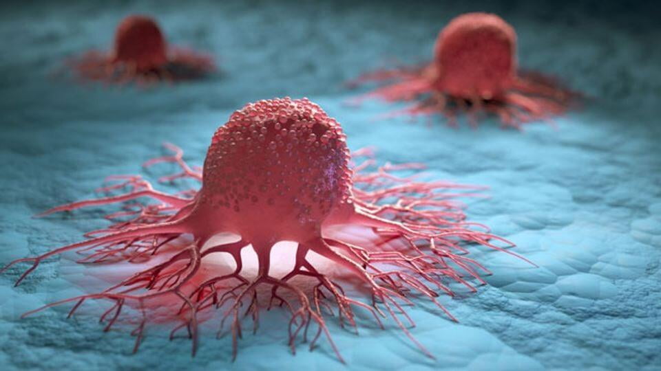 Cancer Can Affect Your Pelvic Floor Health!